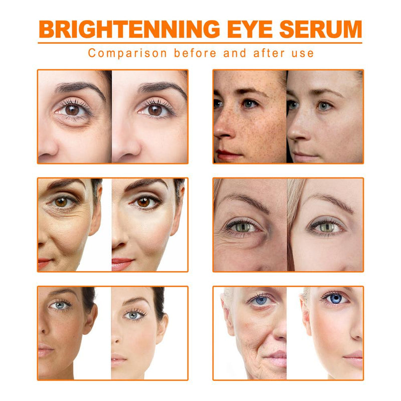 Turmeric Essential Oil 10ml Organic Turmeric Oil For Dark Spots 100 Pure Therapeutic Grade Turmeric Oil For Moisturizing