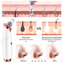 Electric USB Rechargeable Blackhead and Pore Remover